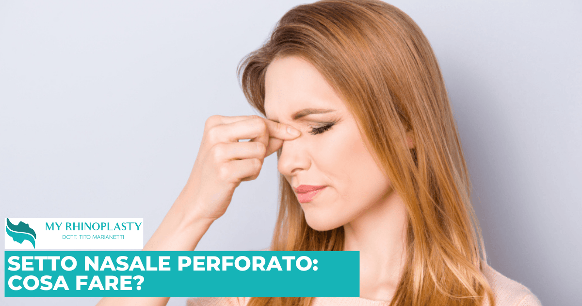 SETTO NASALE PERFORATO