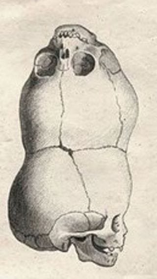 Malformazione