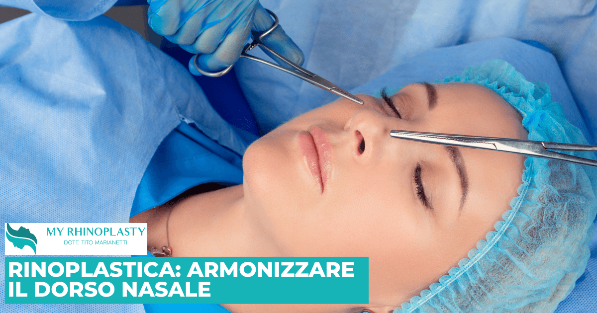 Rinoplastica armonizzare il dorso nasale