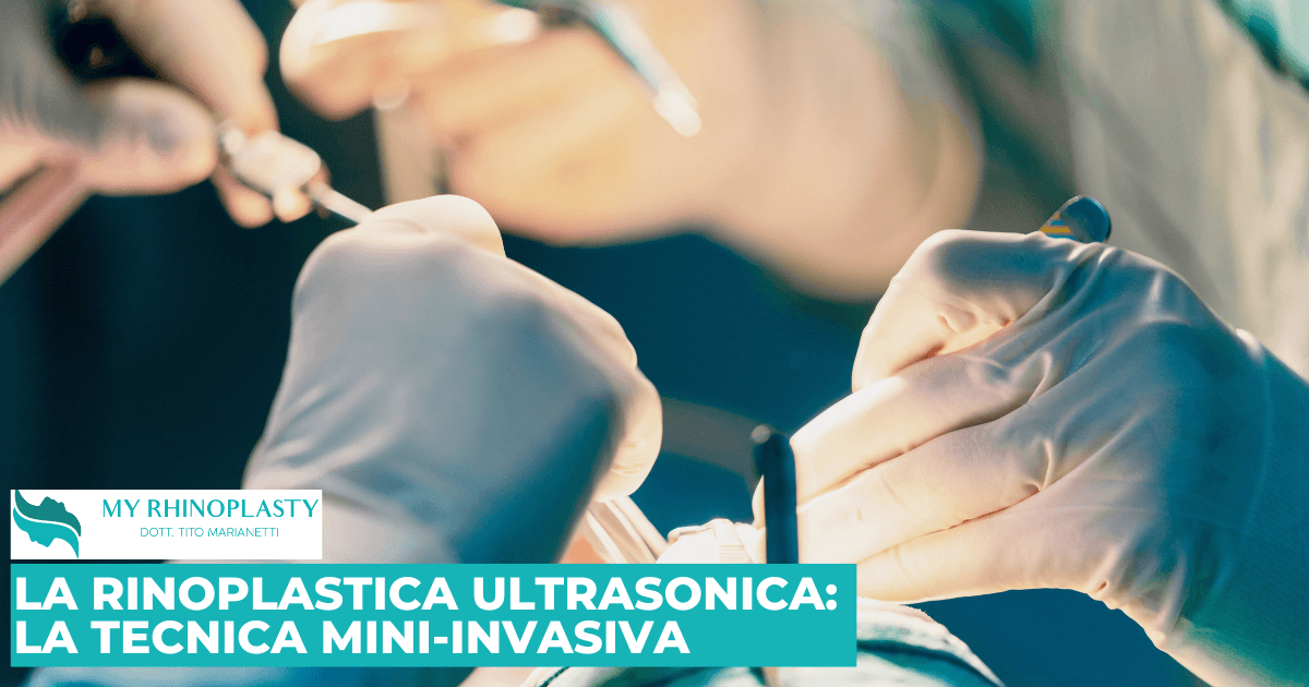 Rinoplastica Ultrasonica