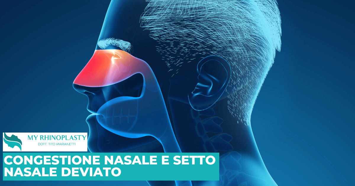 Congestione nasale e setto nasale deviato