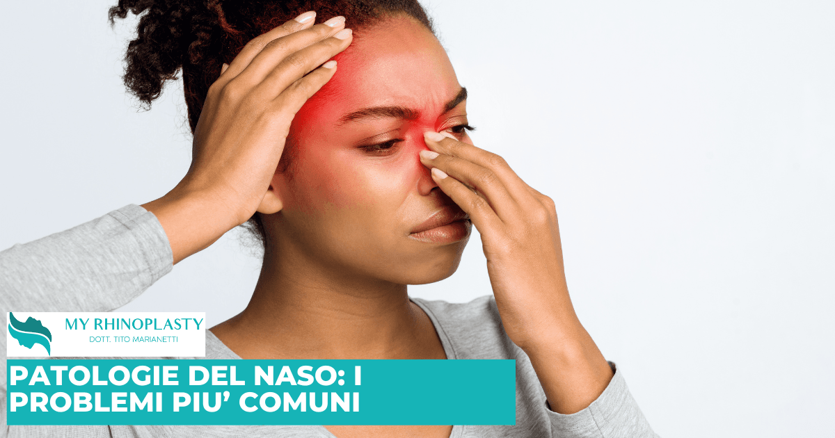 Le patologie del naso