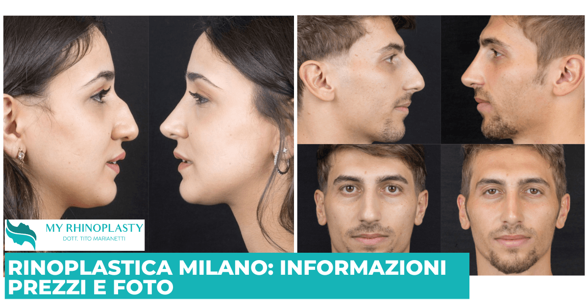RInoplastica Milano