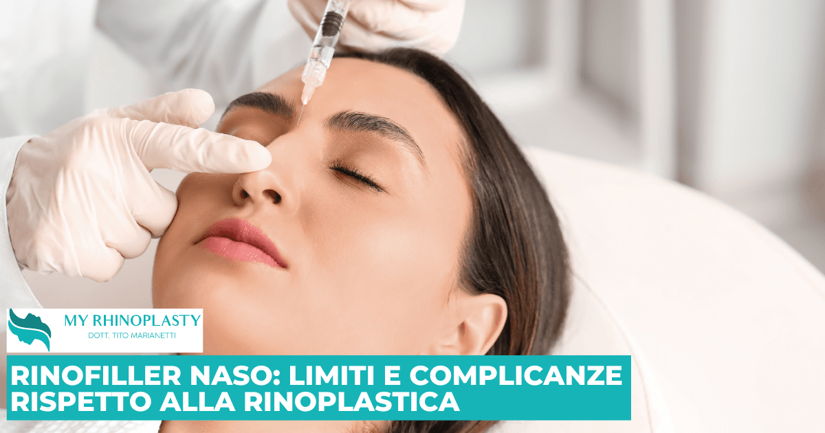 Rinofiller: Limiti e Complicanze Rispetto alla Rinoplastica