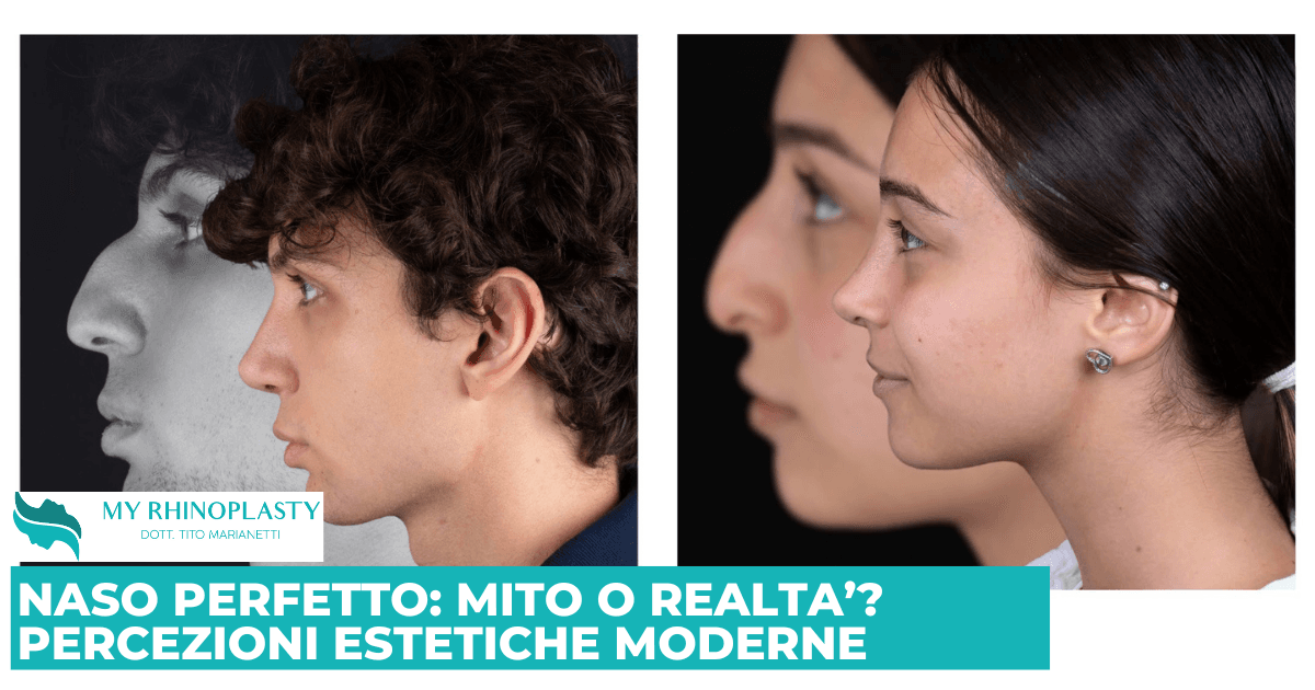 Naso Perfetto: Mito o Realtà? Percezioni Estetiche Moderne