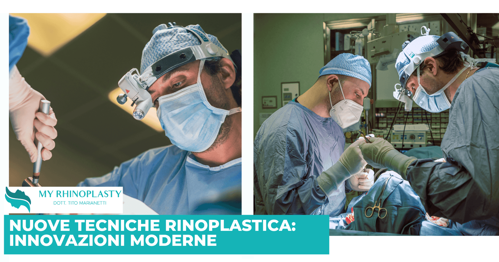 Nuove Tecniche Rinoplastica: innovazioni moderne